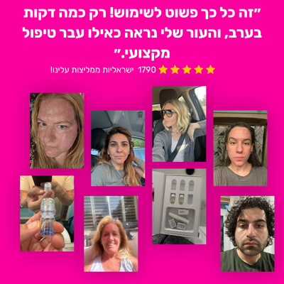 מערכת המיקרונידלינג
