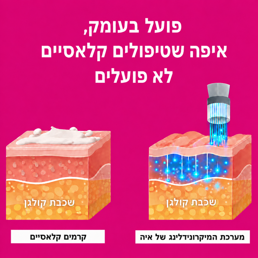 מערכת המיקרונידלינג
