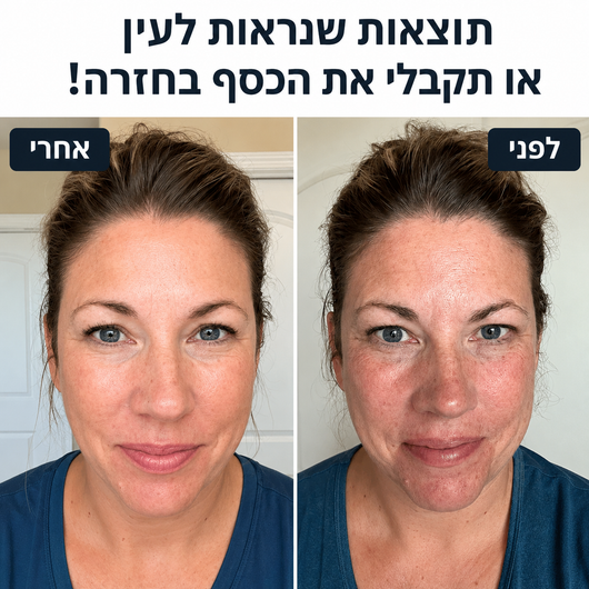 מערכת המיקרונידלינג